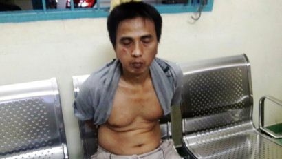  Tên cướp bị nhiễm HIV bị bắt - Ảnh: Công an cung cấp