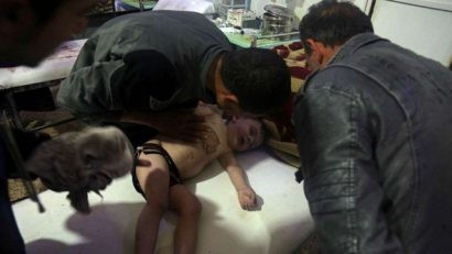  Một em bé nghi bị phơi nhiễm chất độc hóa học trong vụ tấn công hôm 7-4 được chữa trị tại một bệnh viện địa phương ở thị trấn Douma - Ảnh: REUTERS