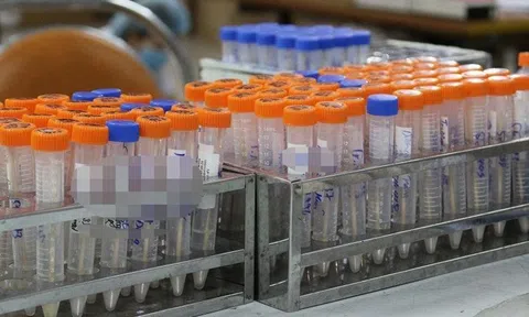 Đưa trang thiết bị y tế, sinh phẩm xét nghiệm vào mặt hàng phải kê khai giá