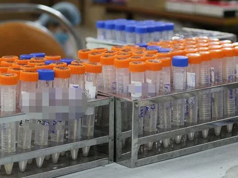 Đưa trang thiết bị y tế, sinh phẩm xét nghiệm vào mặt hàng phải kê khai giá